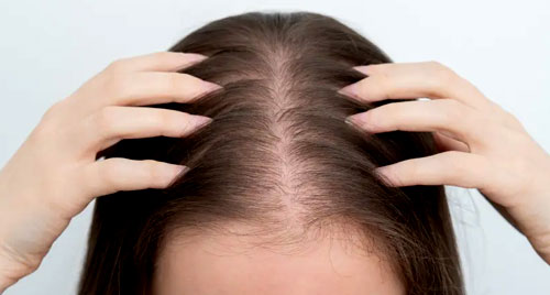 Hair Fall Treatment